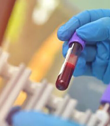 Pruebas de Hematología y Coagulación