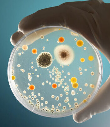 Pruebas de Microbiología